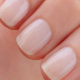 Vogue Esmalte Base de Uñas Escamadas Sos